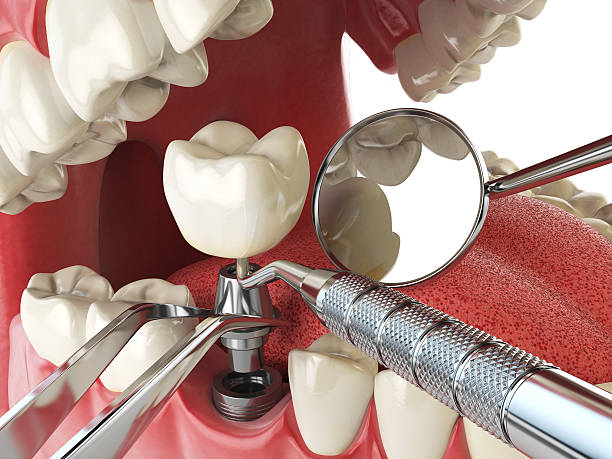 Best Emergency Dental Surgery in Poquott, NY